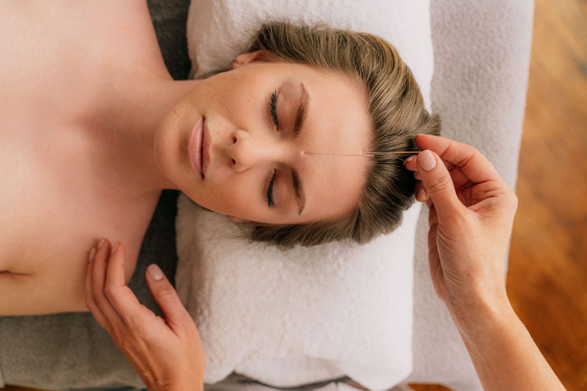 تصویر مربوط به شغل متخصص طب سوزنی - Acupuncturist